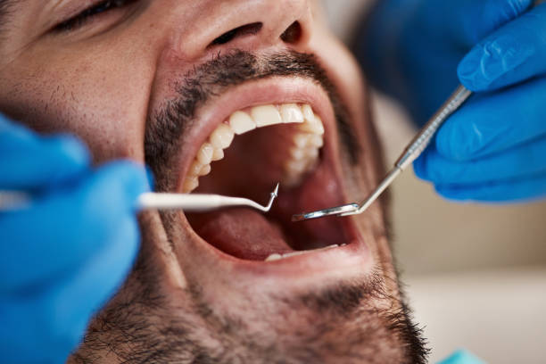 Best Broken or Chipped Tooth Repair in Morro Bay, CA
