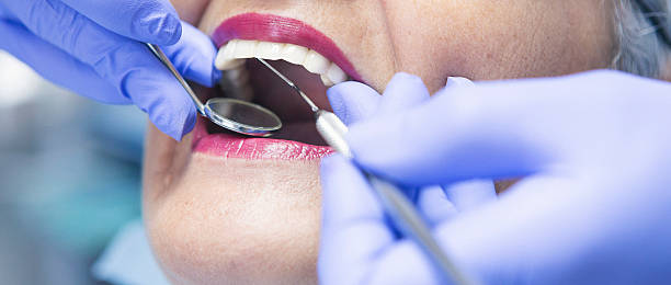 Best Dental Abscess Treatment in Morro Bay, CA
